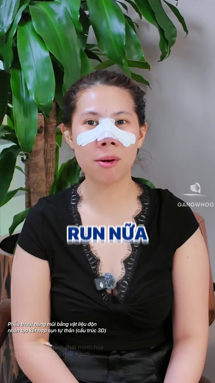 Nâng mũi có thật sự đau như bạn nghĩ, xem ngay video này nhé!