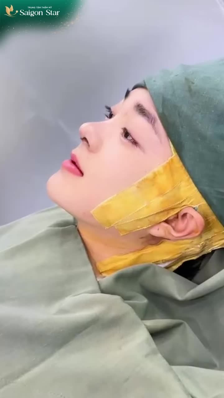 CHỈ NÂNG MỖI DÁNG MŨI THÔI MÀ GÓC NGHIÊNG THAY ĐỔI CỠ NÀO???