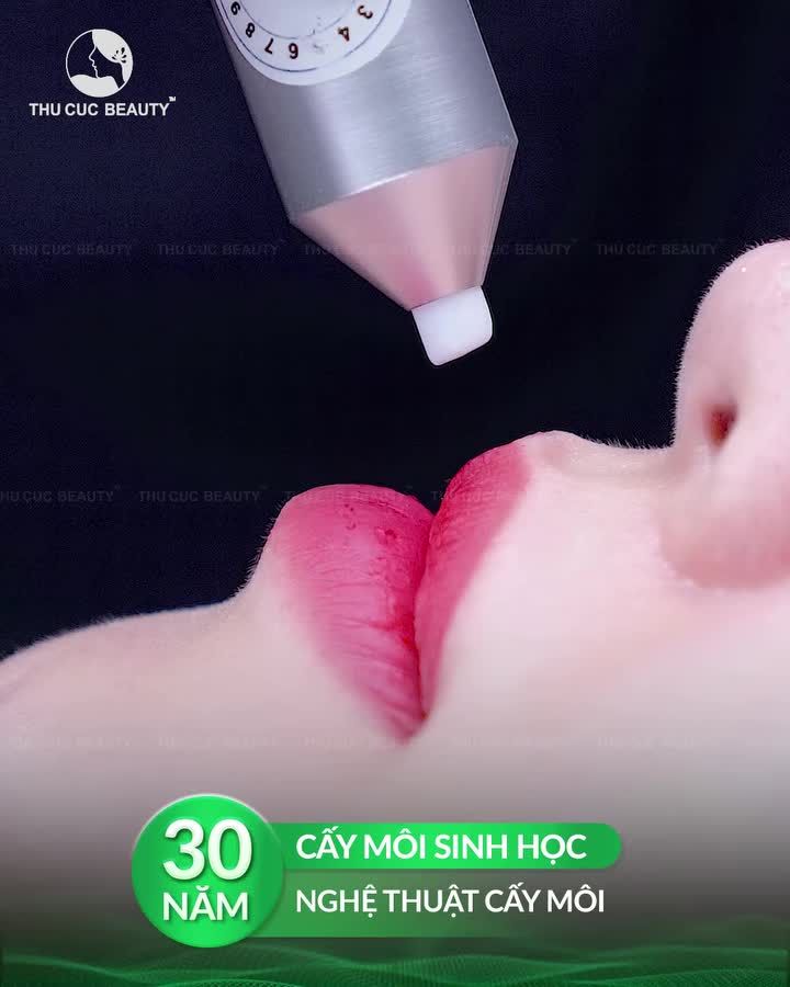 CẤY MÔI SINH HỌC: SẮC MÔI TRONG VEO - CĂNG MỌNG TỰ NHIÊN