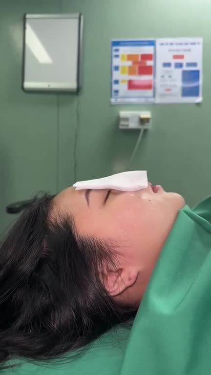 NÓNG NHẤT LÚC NÀY: Việt kiều Mỹ Gen Z sở hữu dáng mũi CAO SANG, CUỐN HÚT tự tin đón hè sau Nâng mũi S Line 3D tại JW