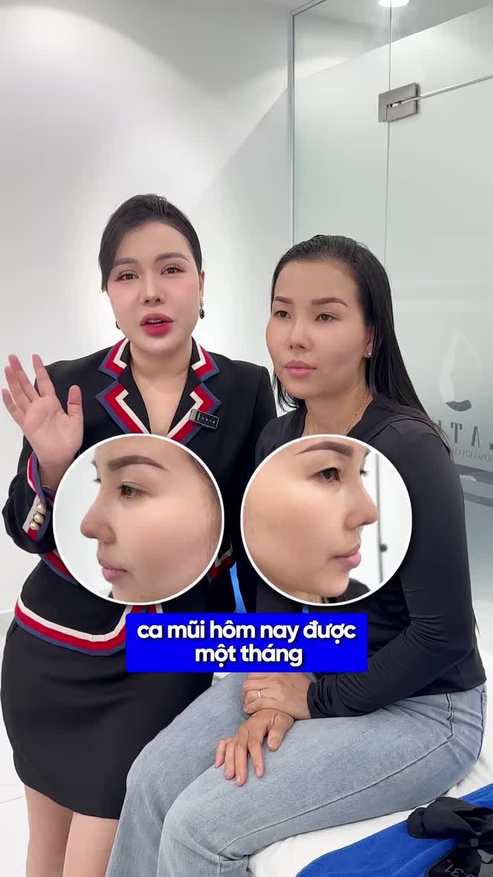 NÂNG MŨI XONG MỚI BIẾT… MỌI LO LẮNG ĐỀU DƯ THỪA