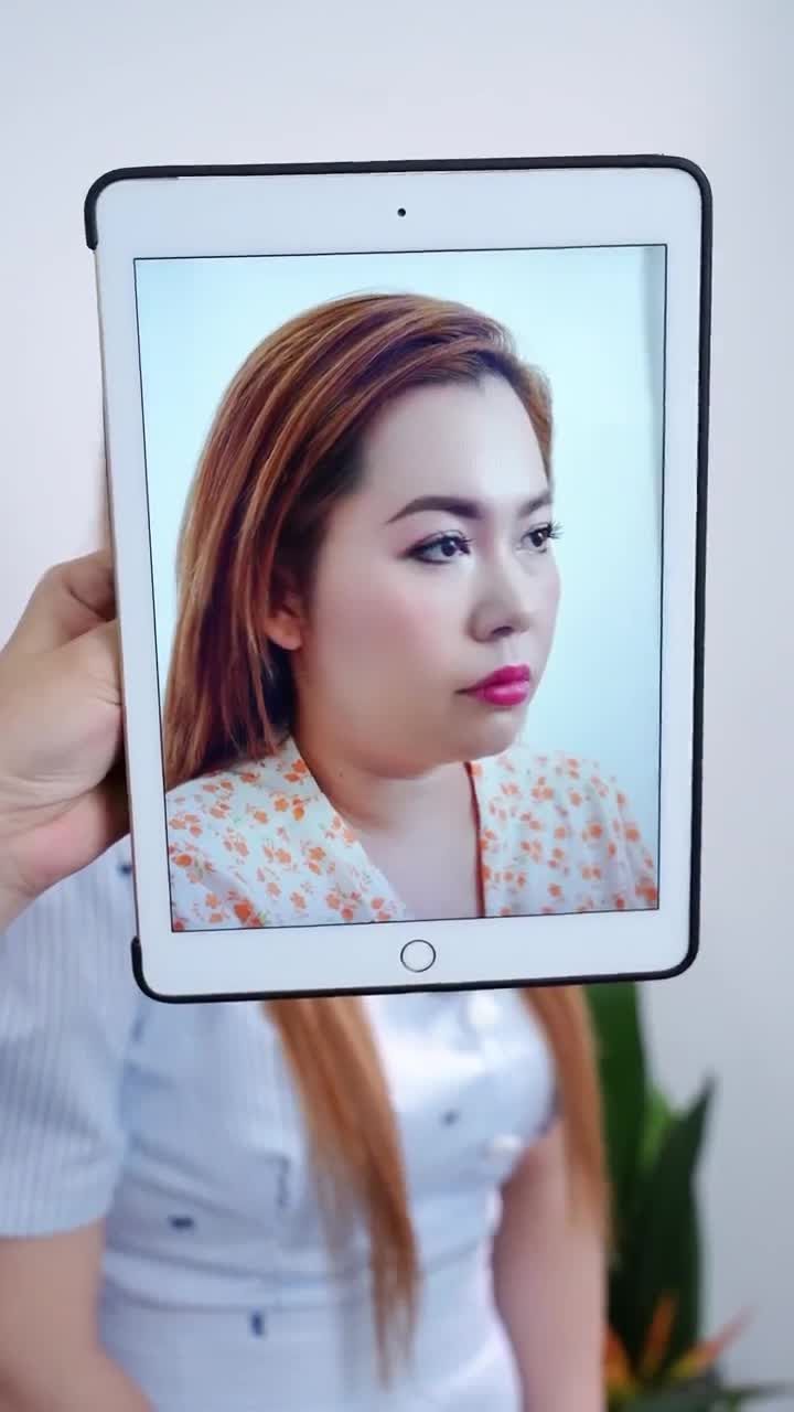 TRỰC TIẾP | KẾT QUẢ SAU 10 NGÀY NÂNG MŨI CẤU TRÚC & HÚT MỠ NỌNG CẰM
