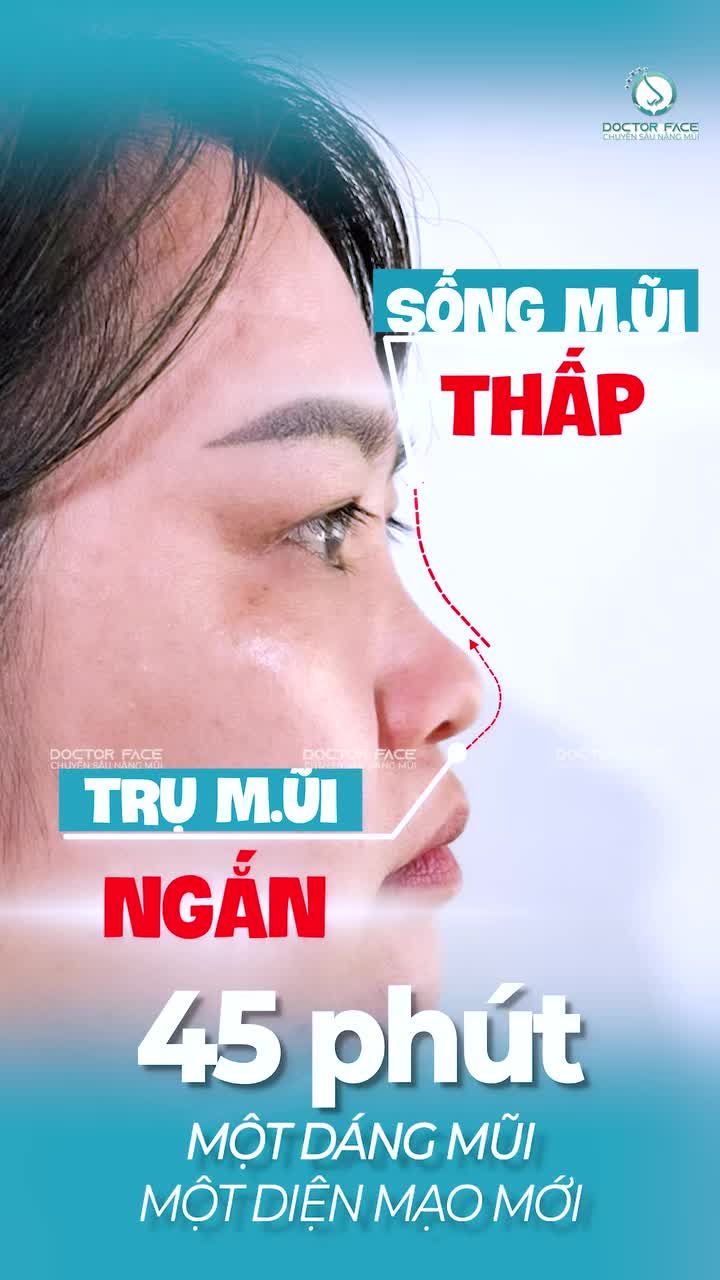 Một dáng mũi đẹp không bắt đầu từ phòng thực hiện, mà bắt đầu từ sự thấu hiểu gương mặt của khách hàng.