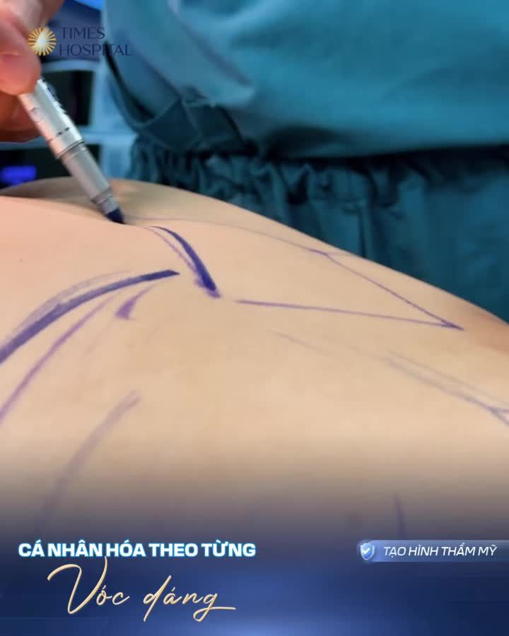 "NHẢ VÍA" EO THON – LẤY LẠI DÁNG ĐẸP SAU SINH