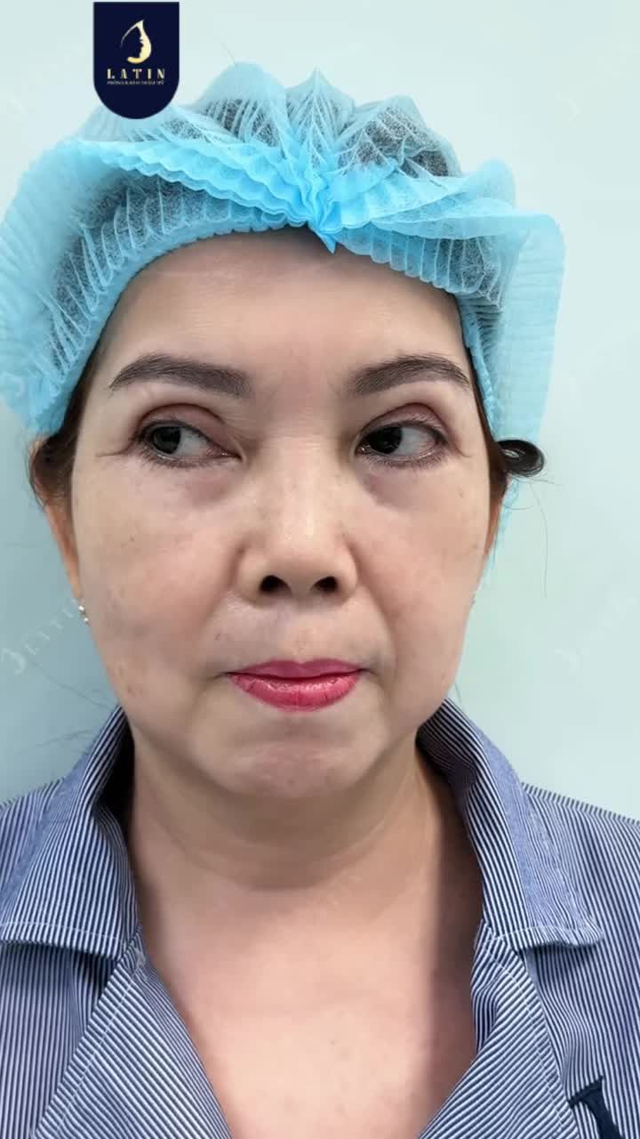 TỪ DÁNG MÍ CHƯA ƯNG Ý ĐẾN ÁNH NHÌN MỀM MẠI HƠN