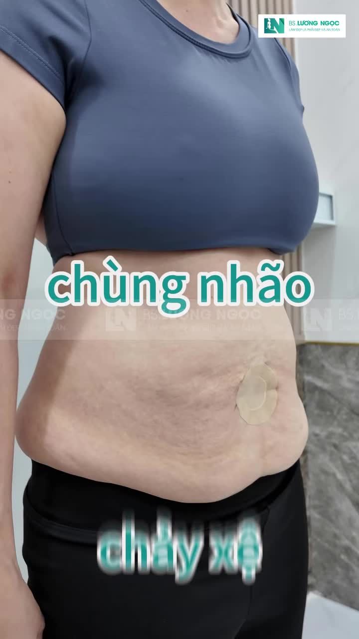 Khoe "chiếc bụng" mới toanh sáng nay nè chị em