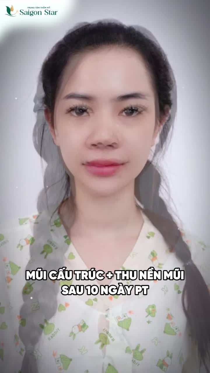 - 10 ngày hậu phẫu - Bắt đầu thấy rõ sự khác biệt.
