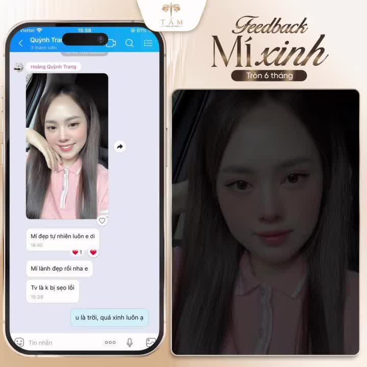 Đầu tuần ngắm ngay chiếc feedback cắt mí "xinh xỉu" từ khách nhà Tấm