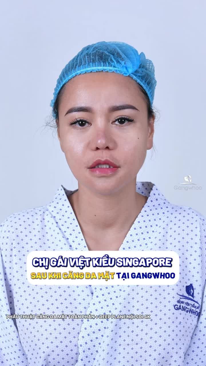 Khi U40 căng da mặt sẽ thay đổi như thế nào?