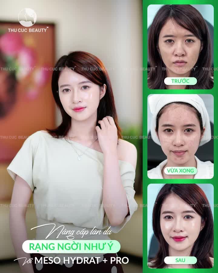 MESO HYDRAT + PRO - TÁI SINH VẺ RẠNG RỠ CHUẨN Y KHOA