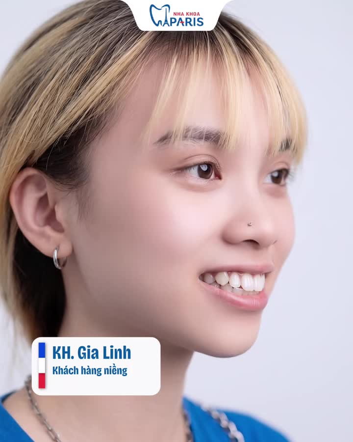 NIỀNG RĂNG MÀ NGỠ "THAY ĐẦU"