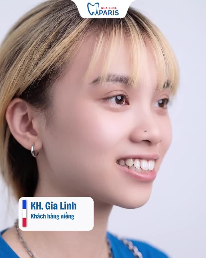 NIỀNG RĂNG MÀ NGỠ "THAY ĐẦU"