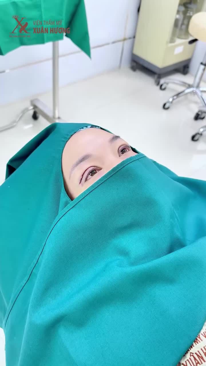 CẮT MÍ TRÊN - TIỂU PHẪU NHỎ NHƯNG THAY ĐỔI BẤT NGỜ