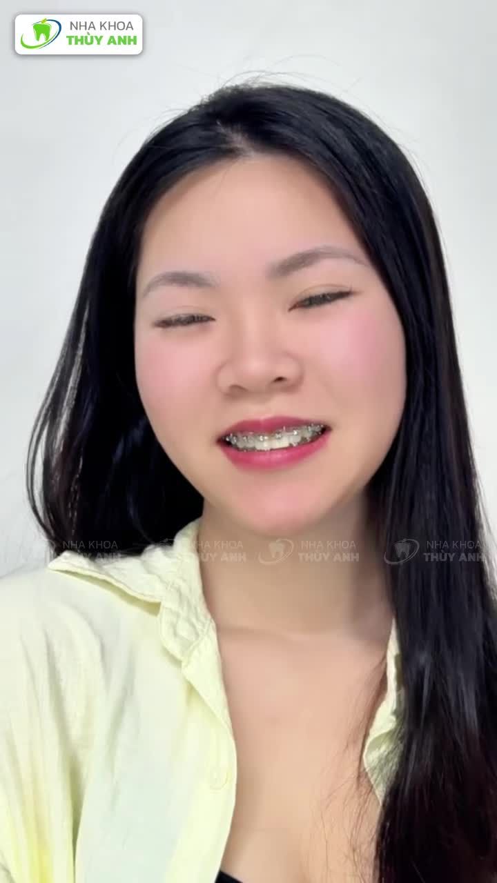 MỘT NỤ CƯỜI NHƯNG LÀ HAI PHIÊN BẢN