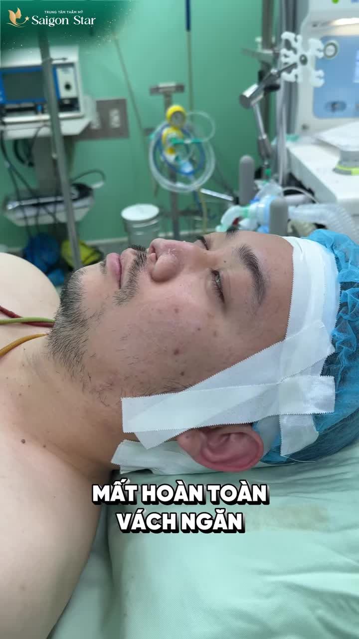 THÀNH CÔNG "GIẢI CỨU" DÁNG MŨI BỊ BIẾN CHỨNG DO TAI NẠN LAO ĐỘNG CHO ANH KHÁCH VIỆT KIỀU MỸ!!!