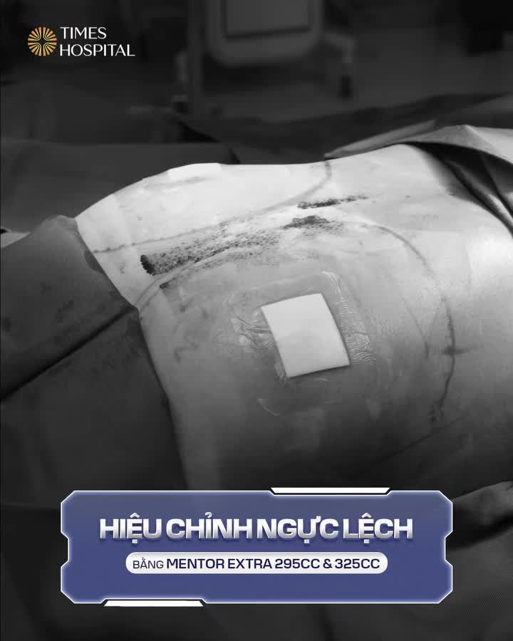MÀN “LỘT XÁC” NÂNG CẤP VÒNG 1 CỰC CHÁY
