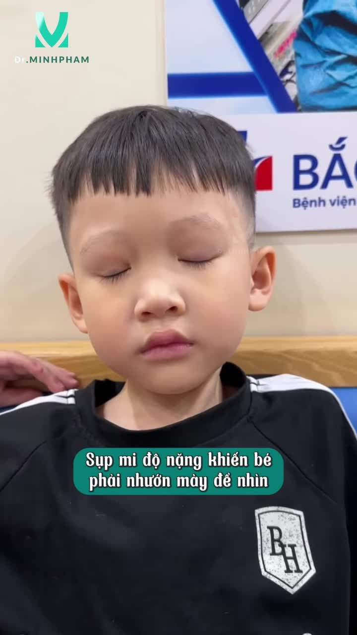 Gần 1 tháng sau phẫu thuật treo VCT, đôi mắt của bé Mạnh Tuân đã hồi phục tốt, ánh nhìn mở rõ ràng hơn, mí mắt cân đối và gương mặt cũng trở nên rạng rỡ hơn từng ngày