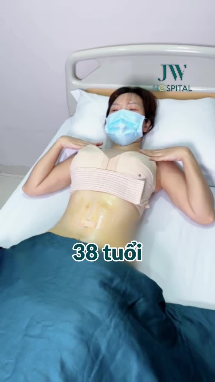 BÁC SĨ JW HÚT MỠ, CĂNG DA BỤNG GIÚP MẸ BỈM 3 CON BIẾN VÒNG 2 NGẤN M.Ỡ HOÁ EO CON KIẾN CHUẨN HOTGIRL