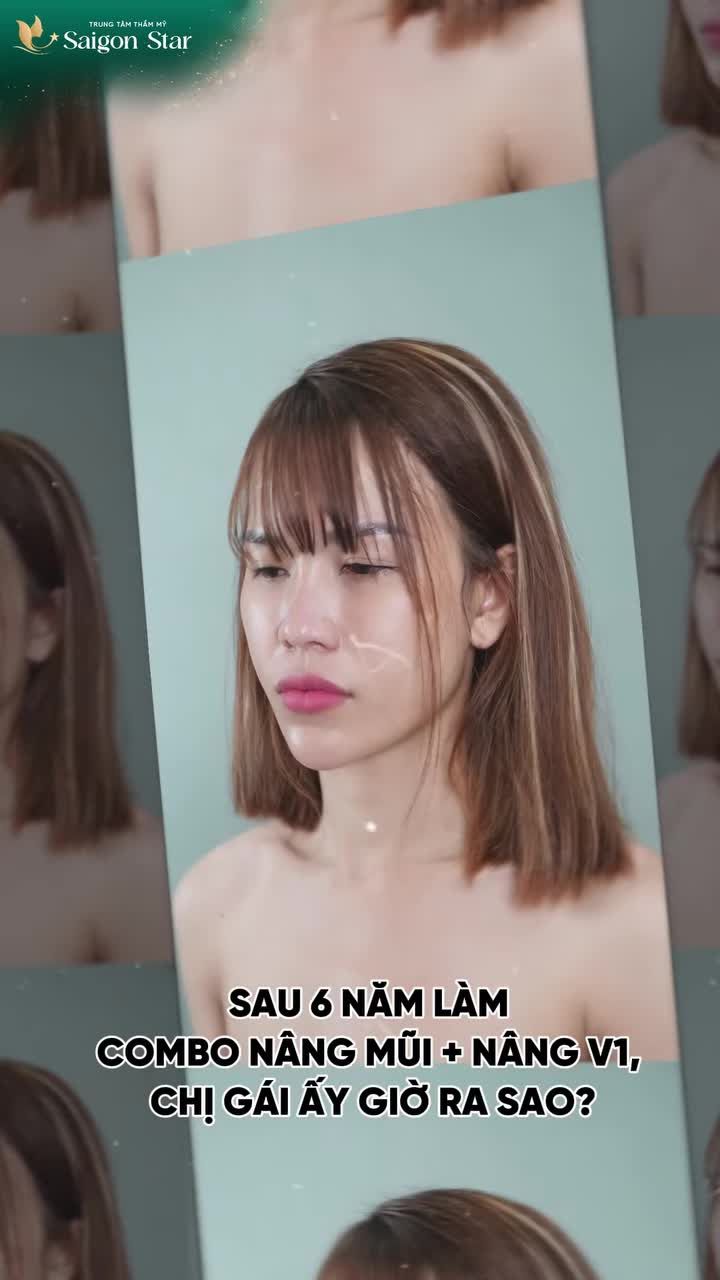 6 NĂM SAU NÂNG MŨI + NÂNG NG Ự C, KHÁCH HÀNG SAIGON STAR GIỜ RA SAO?