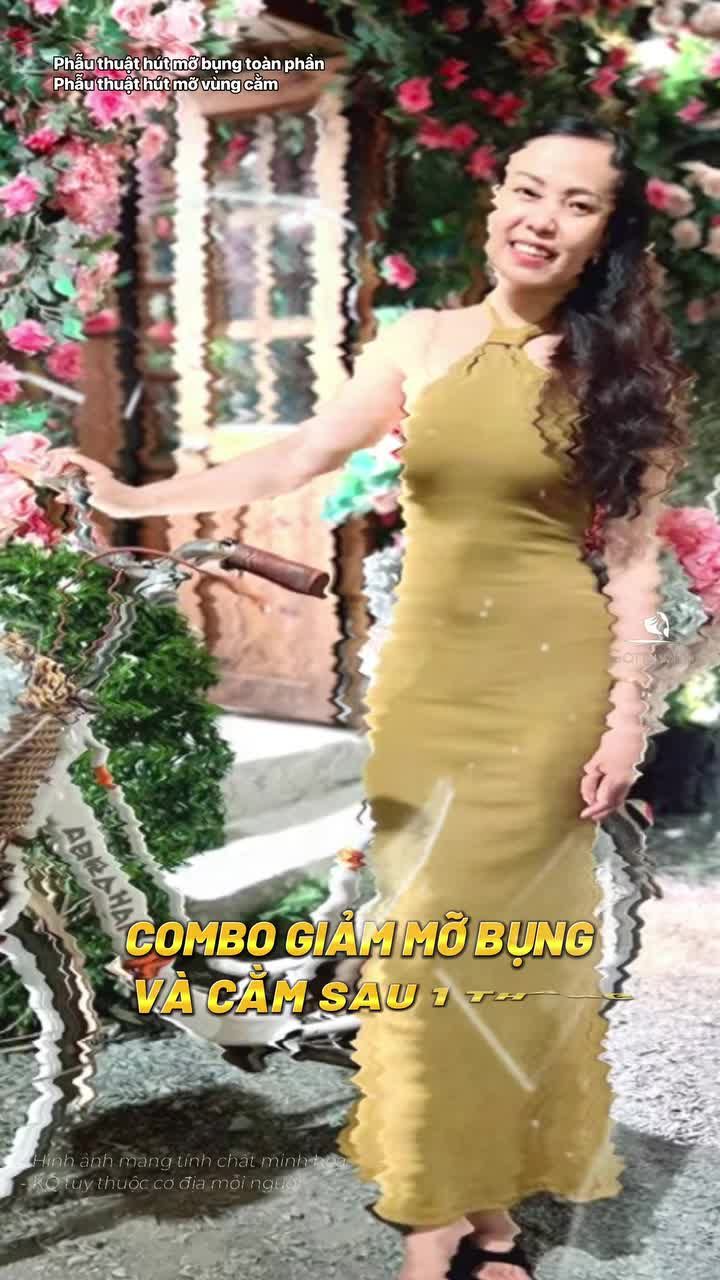 Hành trình khách yêu giảm mỡ bụng và nọng cằm tại Gangwhoo