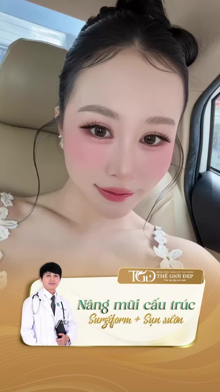 Sau 5 năm, dáng mũi Barbie-Line vẫn là điểm nhấn giúp Quý Cô thêm phần rạng rỡ và cuốn hút.