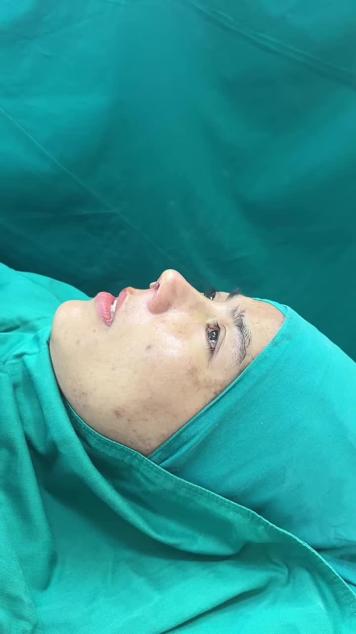 Mũi cấu trúc surgiform xử lý xương