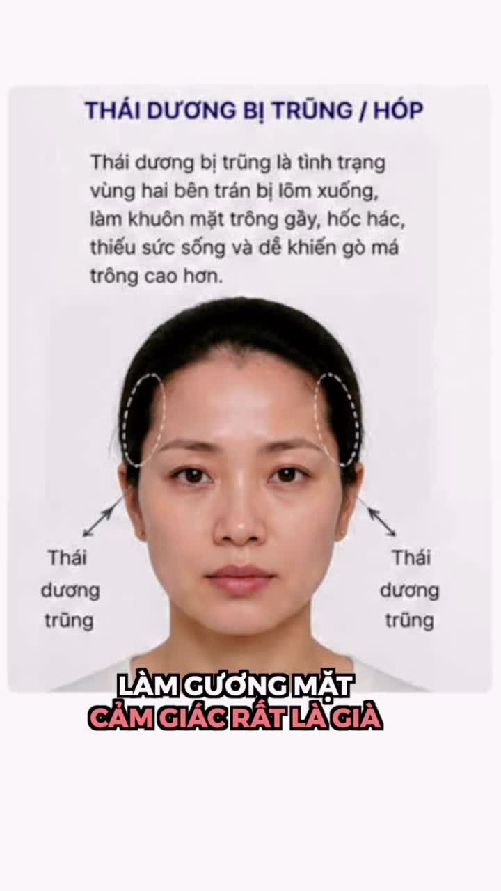 Thái dương đầy đặn không chỉ giúp gương mặt cân đối hơn mà còn mang đến vẻ ngoài trẻ trung, rạng rỡ và đầy sức sống.