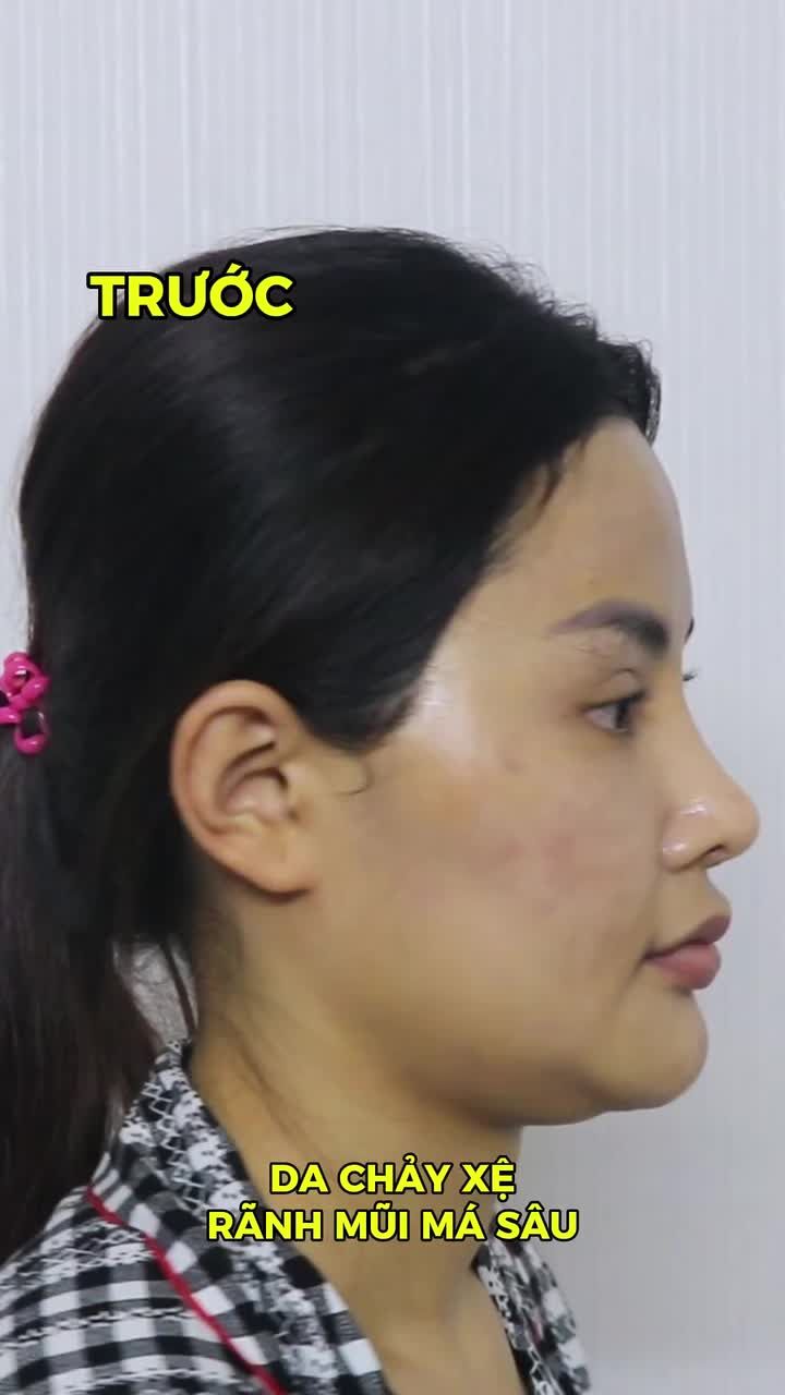 180 PHÚT CHO MỘT DIỆN MẠO MỚI
