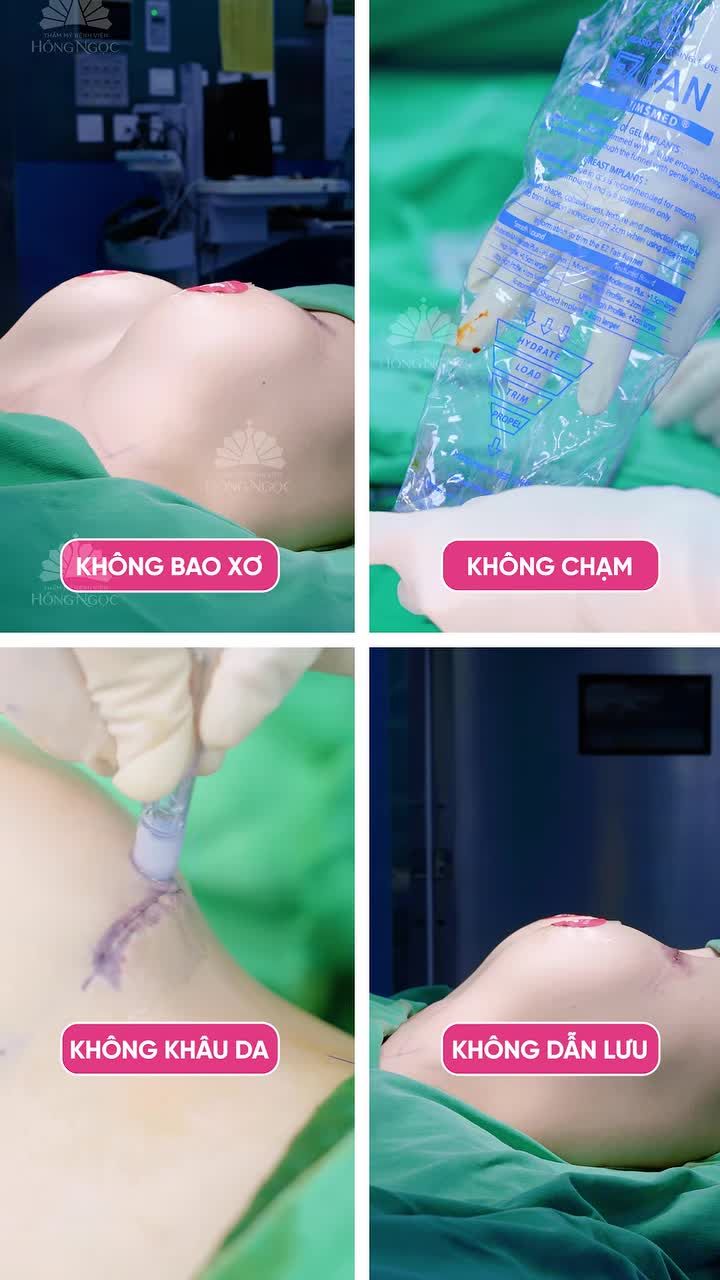 NÂNG NGỰC 4 KHÔNG - CHUẨN MỰC MỚI CHO V1 ĐẸP AN TOÀN, BỀN VỮNG