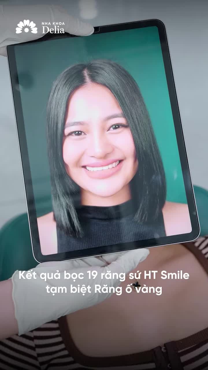 NỤ CƯỜI MỚI RẠNG RỠ VỪA HOÀN THIỆN TẠI DELIA!