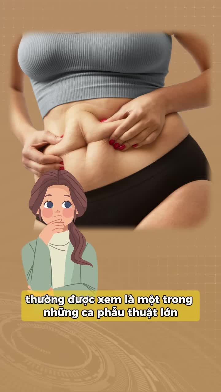 Giải mã công nghệ tạo hình thành bụng
