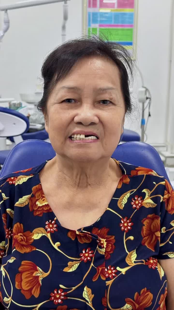 Làm răng thẩm mỹ mà làm sai chỉ định thì chỉ rước thêm họa vào thân!