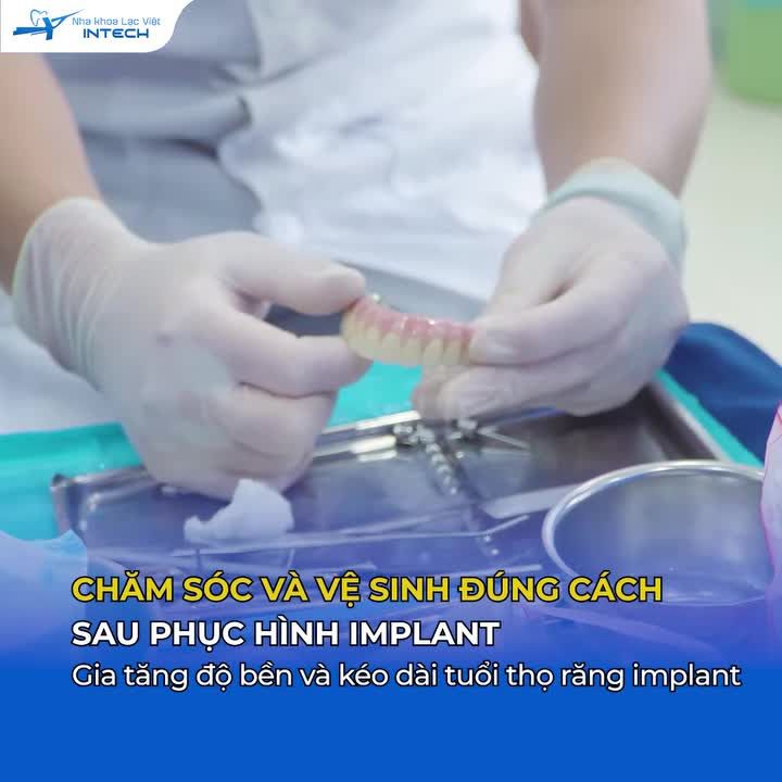 Chăm sóc và vệ sinh đúng cách sau phục hình mới là yếu tố quyết định tuổi thọ của hàm răng Implant