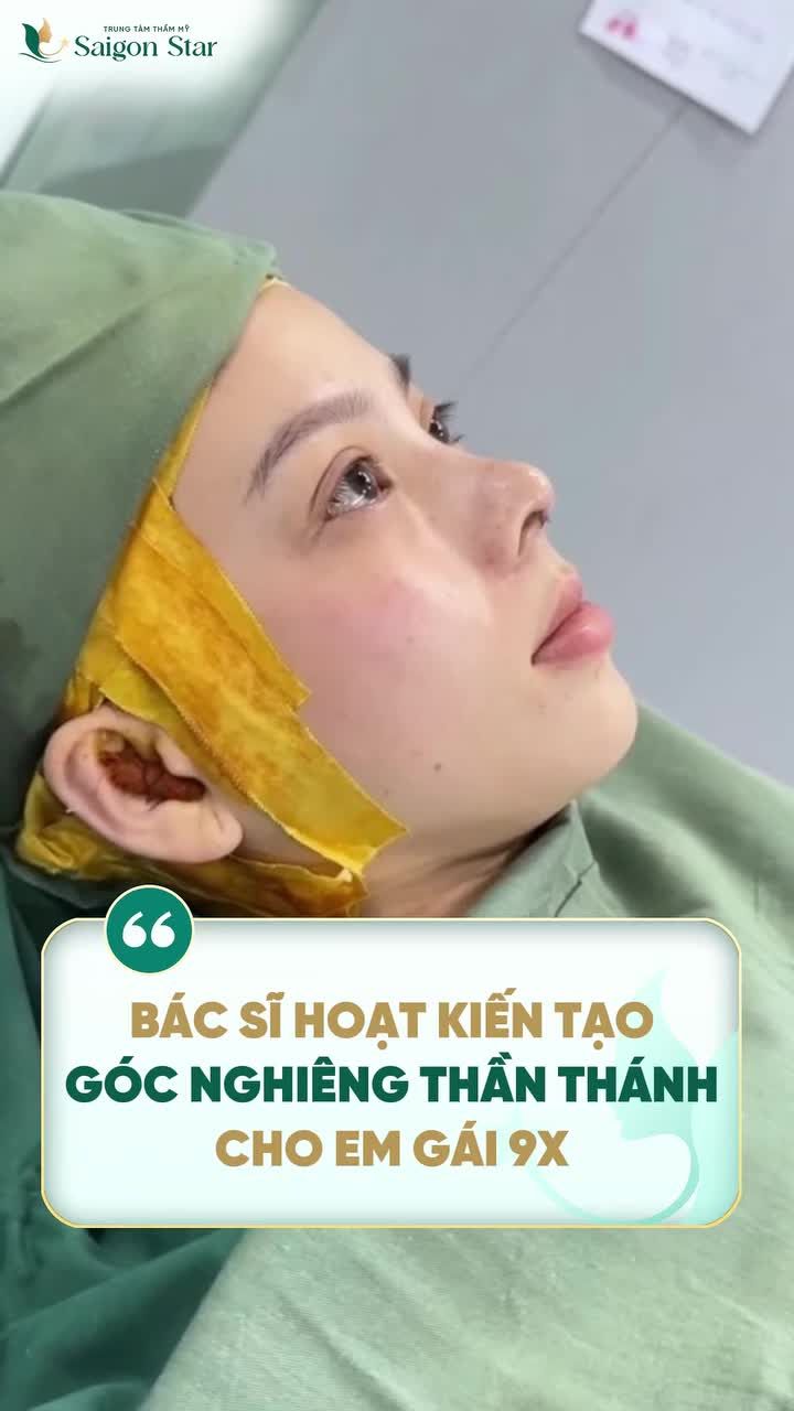 NÂNG MŨI CẤU TRÚC DR. HOẠT - THÀNH CÔNG KIẾN TẠO GÓC NGHIÊNG SAU 60 PHÚT