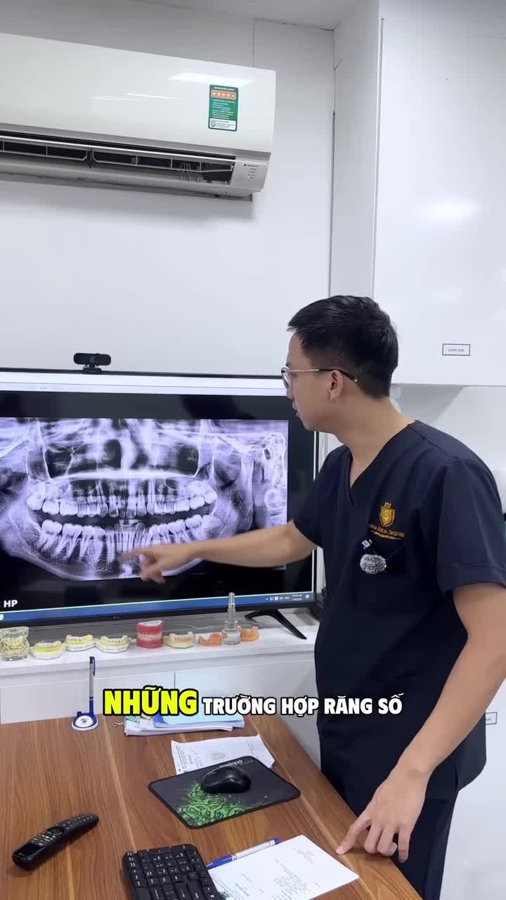 Răng khôn mọc lệch cắn vào má, nhồi nhét thức ăn và sai khớp cắn bắt buộc phải loại bỏ để triệt tiêu hoàn toàn nguy cơ viêm nhiễm.