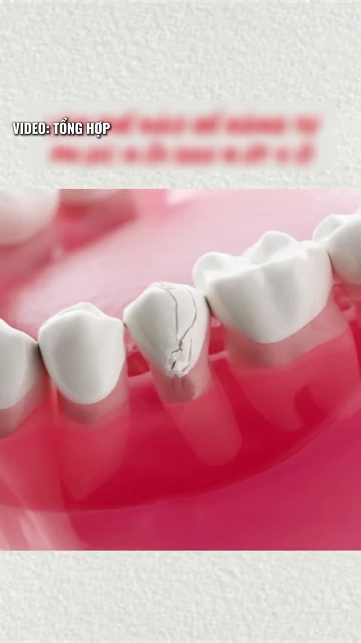 Đau răng không chỉ do sâu răng. Coi chừng bạn đang mắc phải 1 trong 3 nguyên nhân này.