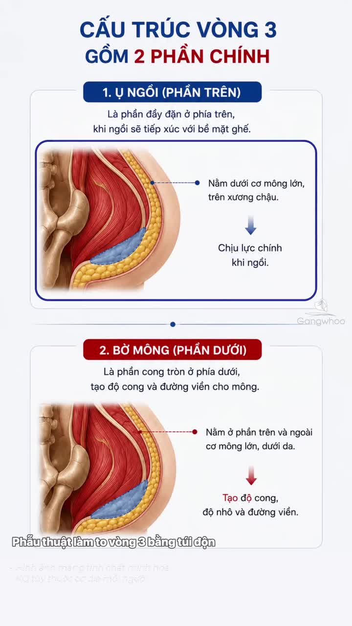 Nâng vòng 3 xong có ảnh hưởng đến sinh hoạt hằng ngày không