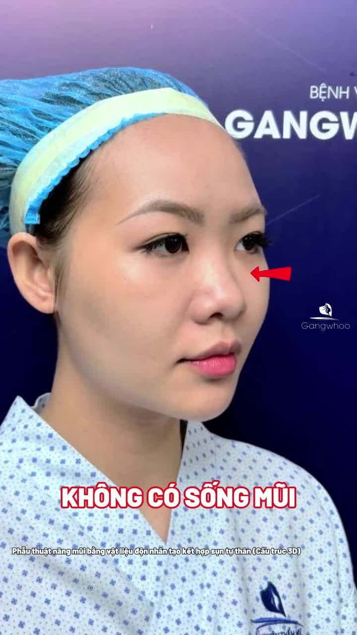 Hành trình trở hữu chiếc mũi mình hằng ao ước