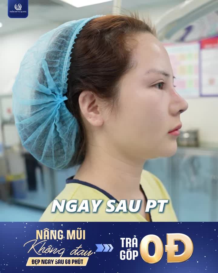Có những thay đổi không chỉ nằm ở gương mặt, mà bắt đầu từ khoảnh khắc bạn quyết định yêu thương bản thân nhiều hơn một chút.