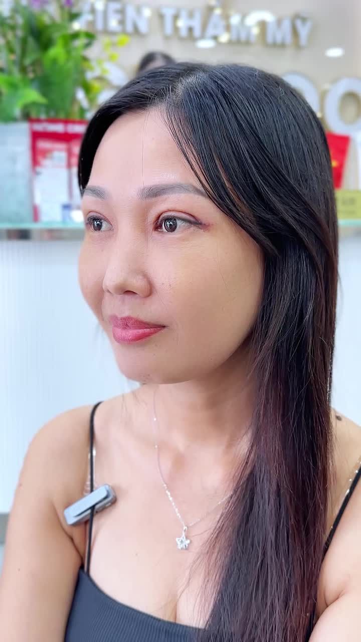 LẤY LẠI 8 TUỔI THANH XUÂN VỚI ĐÔI MẮT TƯƠI TRẺ SAU 7 NGÀY!