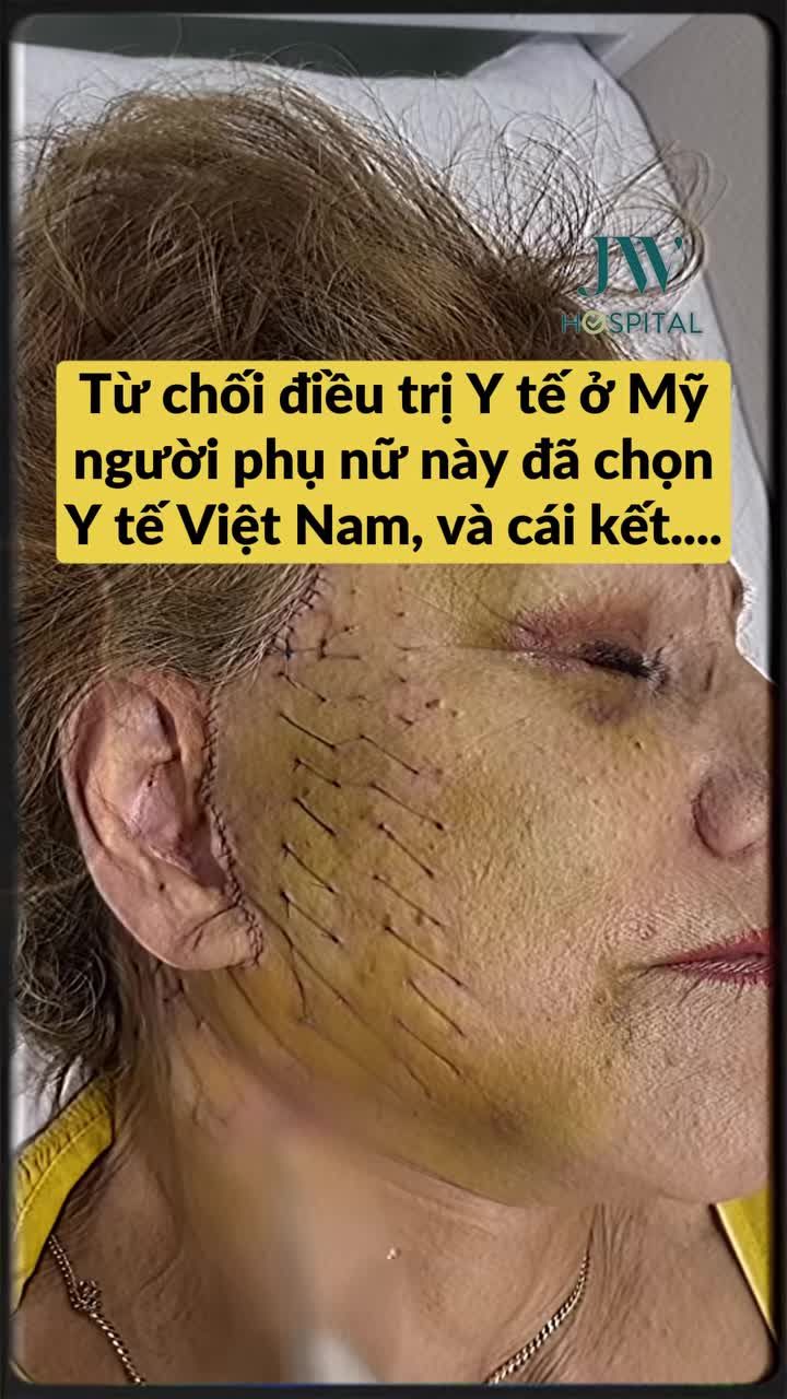 BÀ NGOẠI U80 TỪ CHỐI ĐIỀU TRỊ Y TẾ TẠI MỸ CHỌN Y TẾ VIỆT NAM VÀ CÁI KẾT…