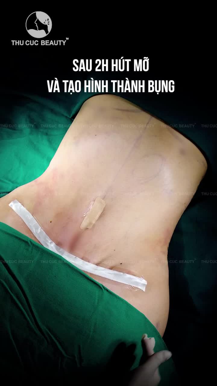 Khoảnh khắc mong chờ nhất Vòng eo mới đã lộ diện chỉ sau 2H đồng hồ