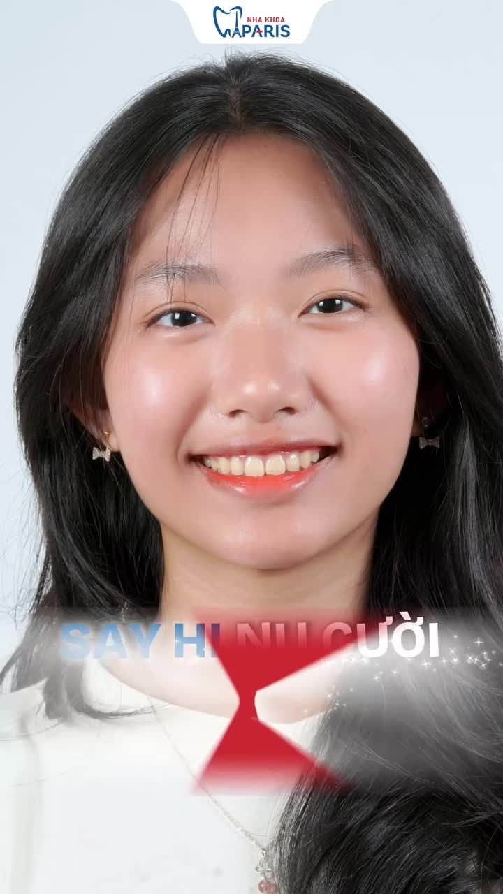 BYE BYE HÀM RĂNG CHÌA KÉM XINH – SAY HI NỤ CƯỜI ĐỀU ĐẸP TỰ TIN!