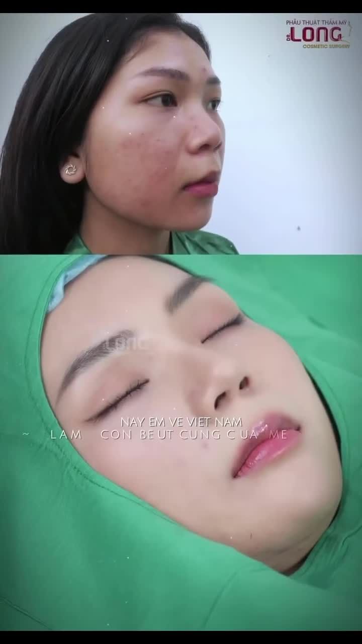THẤT TỊCH - NÂNG DÁNG MŨI VÀNG CHỈ TỪ 12.000.000Đ