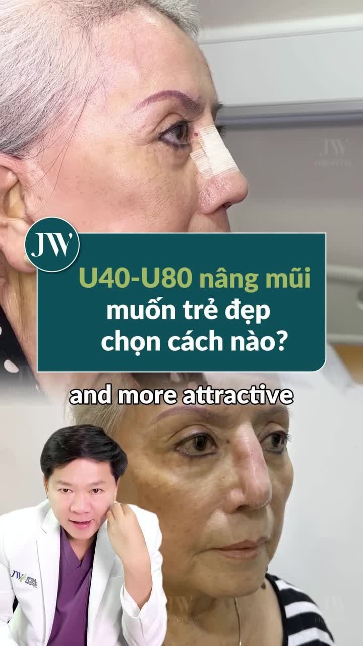 BÁC SĨ TÚ DUNG CHỈ RA 2 PHƯƠNG PHÁP NÂNG MŨI GIÚP CHỊ EM U40–U80 TRẺ HƠN 10 TUỔI