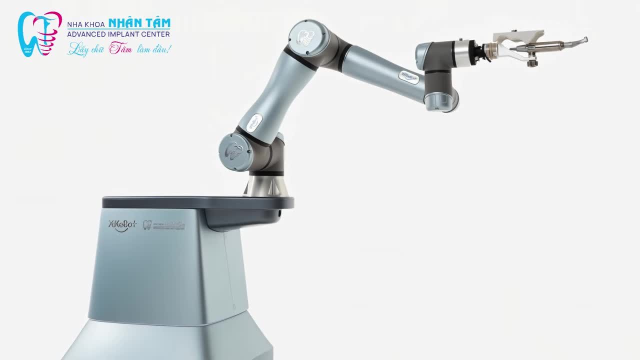 ROBOT IMPLANT HOẠT ĐỘNG NHƯ THẾ NÀO TRONG CA PHẪU THUẬT IMPLANT?