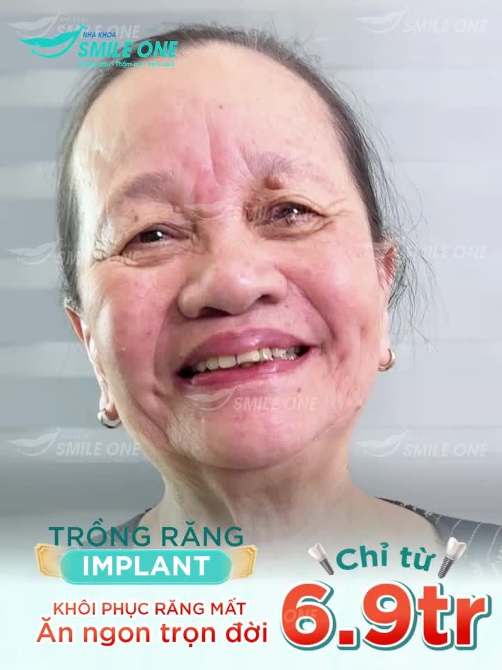 U80 MẤT NHIỀU RĂNG ĐÃ KHÔI PHỤC THÀNH CÔNG NHƯ THẾ NÀO?