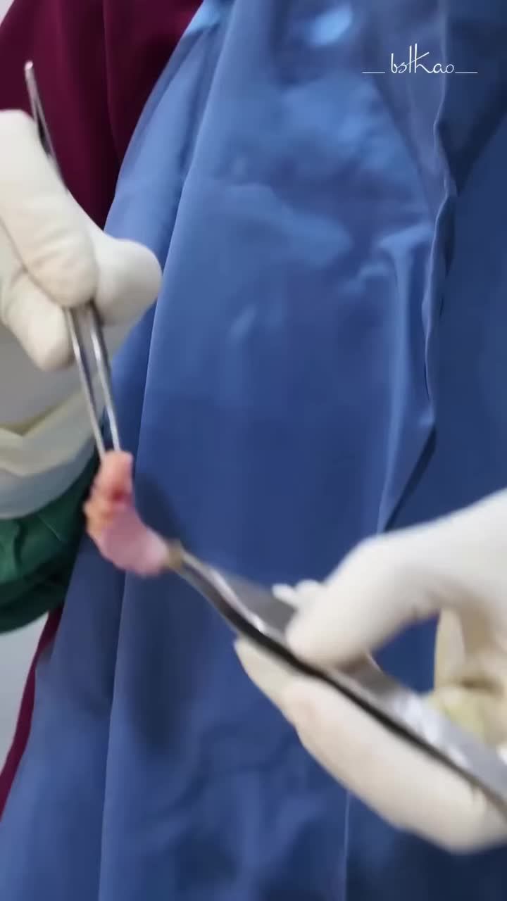 Nâng mũi nhưng không muốn sống mũi cứng đờ? Hãy tìm hiểu DERMAL FATGRAP - Nâng mũi trung bì!