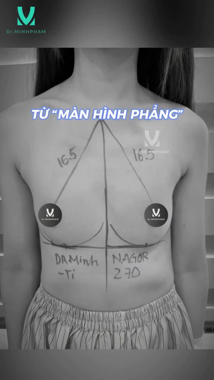 15 NGÀY SAU NÂNG CẤP V1 – SỰ THAY ĐỔI RÕ RỆT TỪ VẺ ĐẸP ĐẾN SỰ TỰ TIN