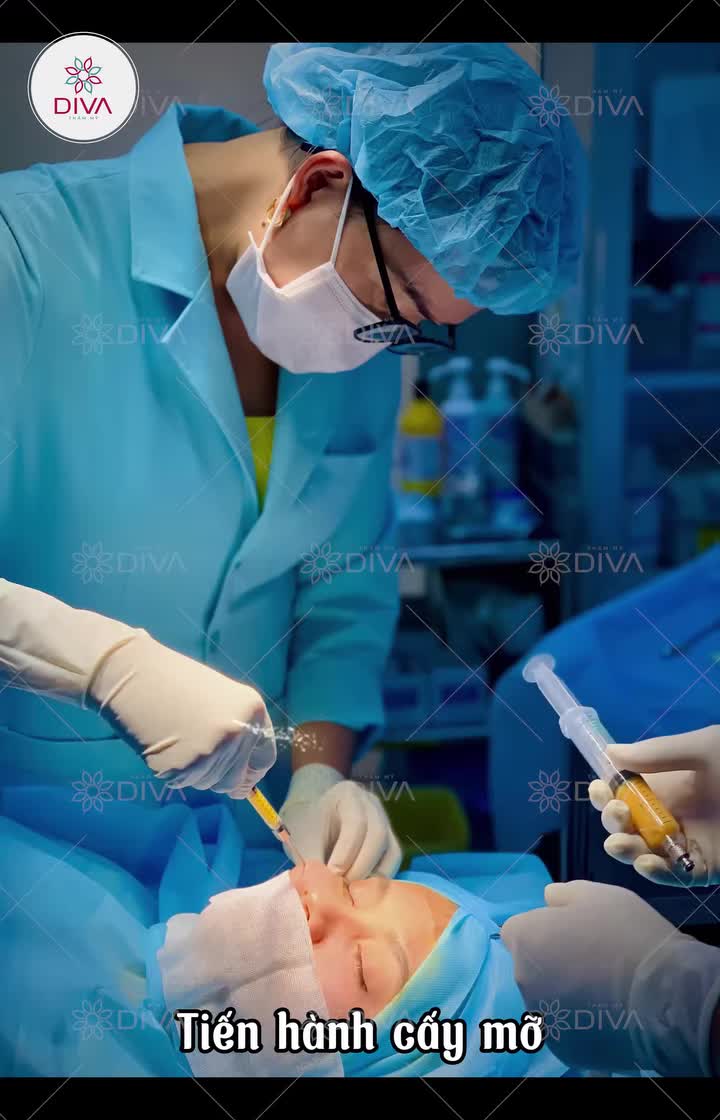 CẬN CẢNH KQ CẤY MỠ KHUYẾT LÕM MÍ DƯỚI SẼ NHƯ THẾ NÀO?